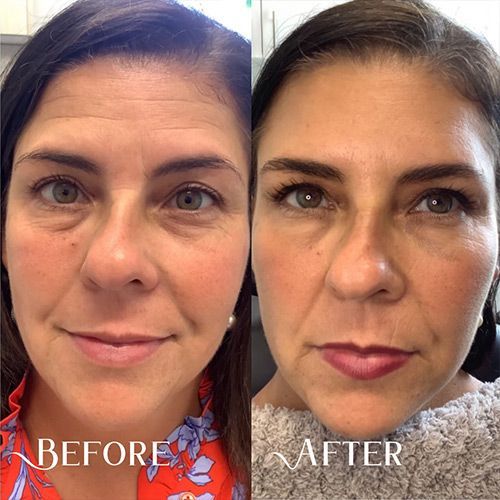 Jacksonville's Skin Treatment Experts Neo Derm Medical Spa