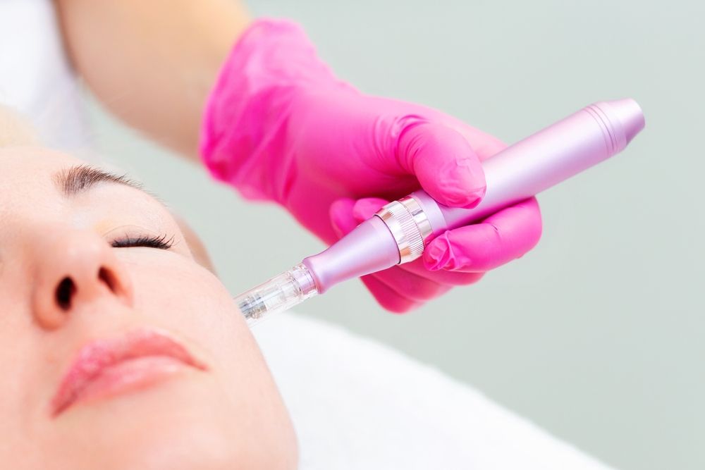 Close-up of a woman receiving microneedling treatment. Pink-gloved hand holds device near face.