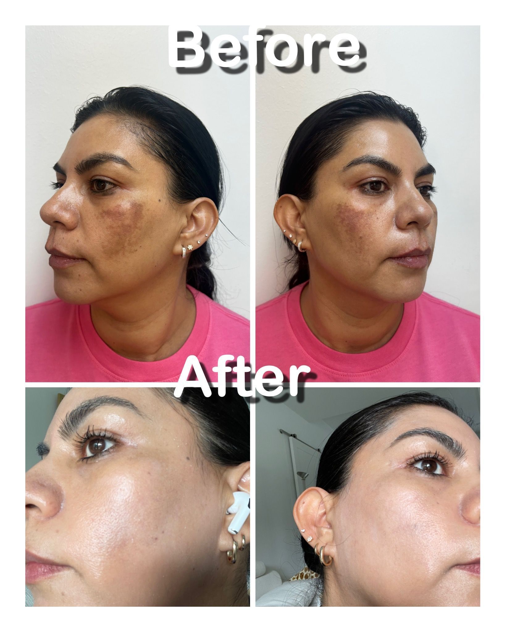 A before and after photo of a woman 's face