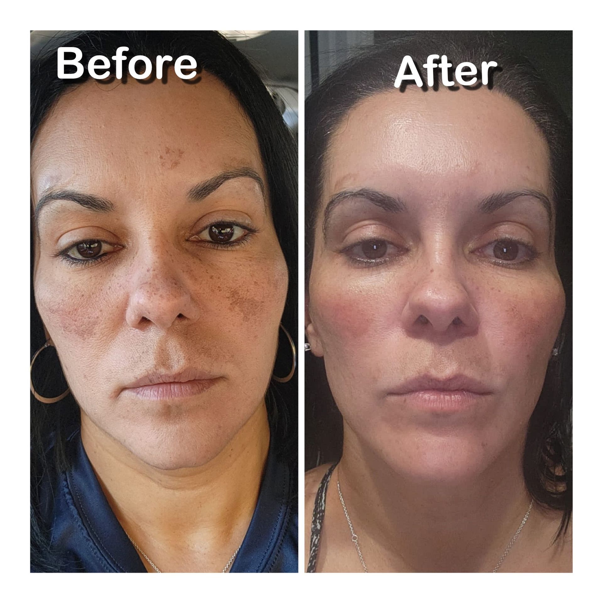 A before and after photo of a woman 's face.