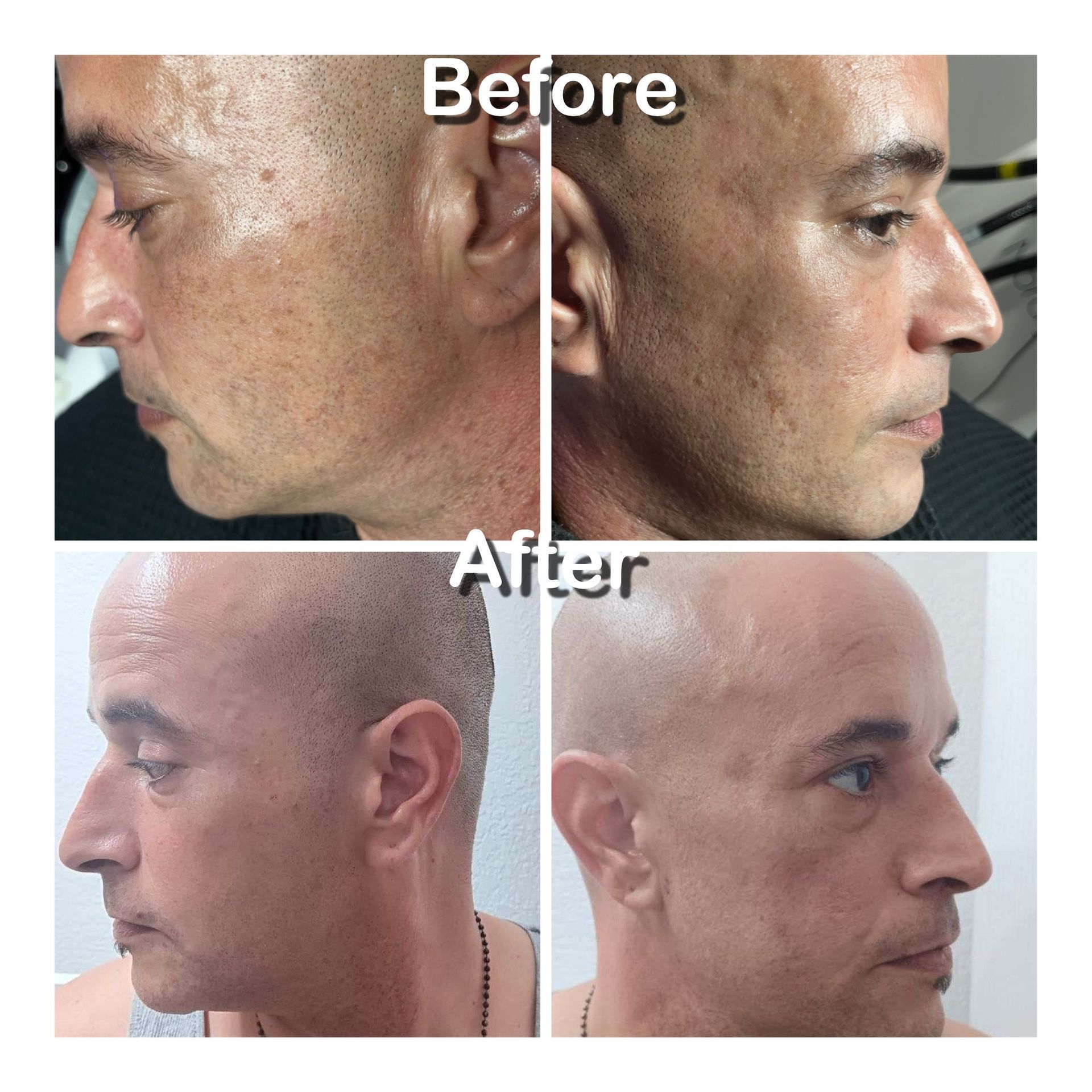 A before and after photo of a man 's face