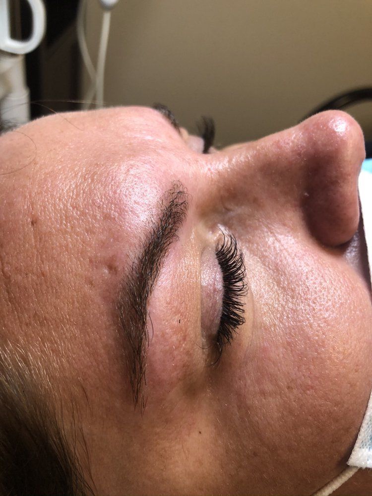 Close-up side view of a person with groomed eyebrows and eyelash extensions, viewed in a clinical setting.
