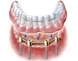trattamento dentistico