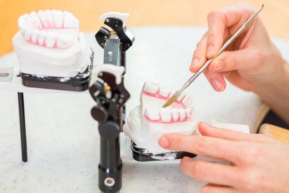 creazione di calco dentale