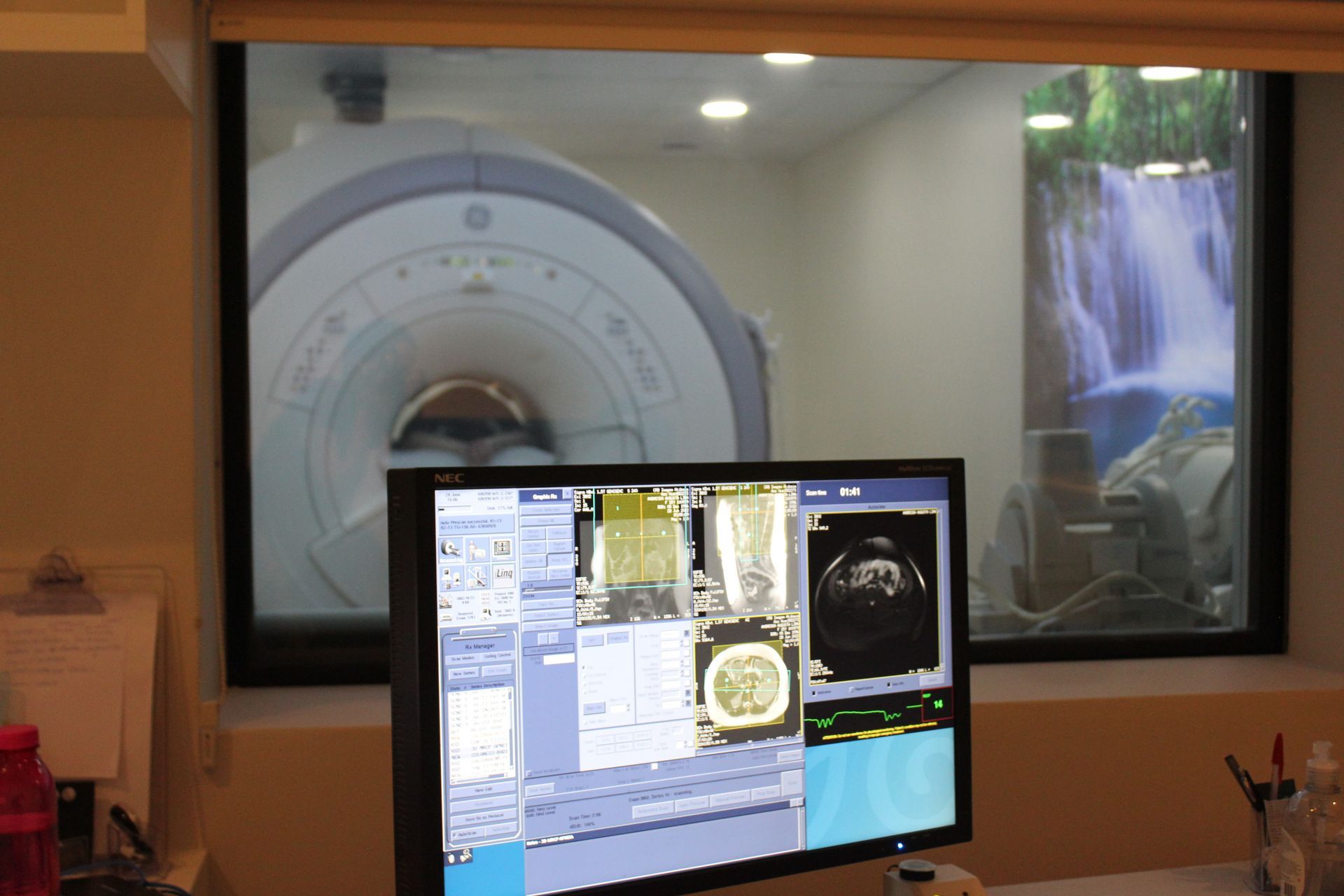 Aparelho de ressonância magnética visível através de uma janela, com um monitor de computador 