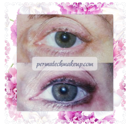 Comparison of eye before and after permanent eyeliner.