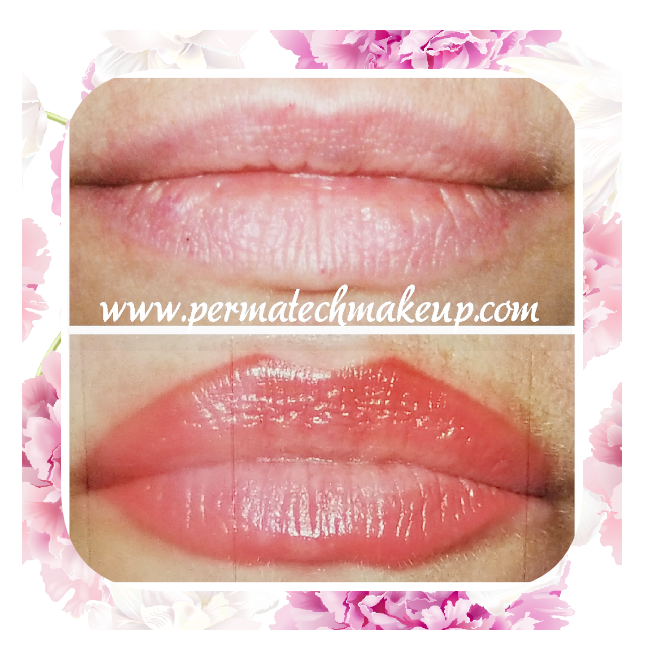 Before and after photos of lip enhancement, showing lip color transformation.