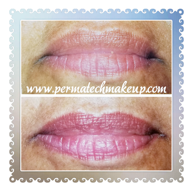 Before and after photos of lip enhancement, showing lip color change.