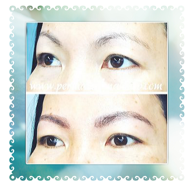 Comparison of eyebrows before and after a cosmetic procedure.