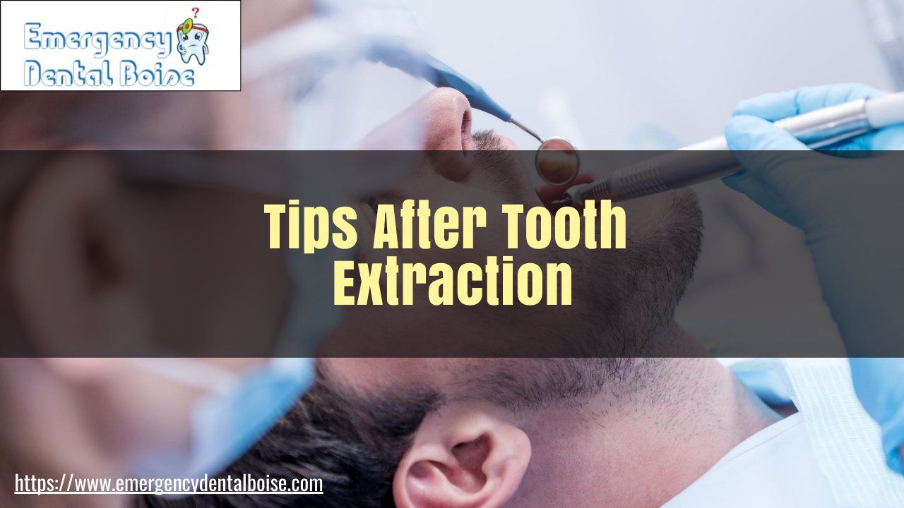 Tips After Tooth Extraction Book An Appointment