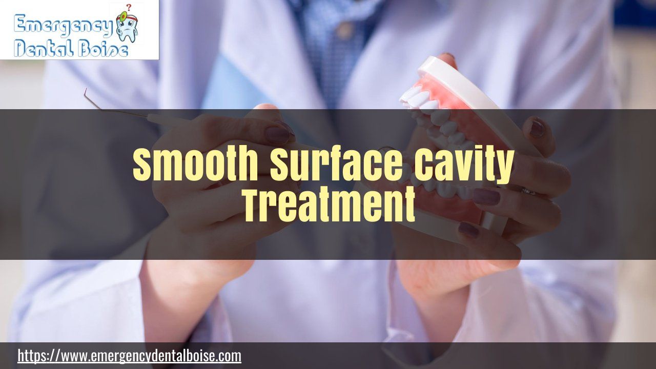 understanding-smooth-surface-cavity-with-boise-dentist