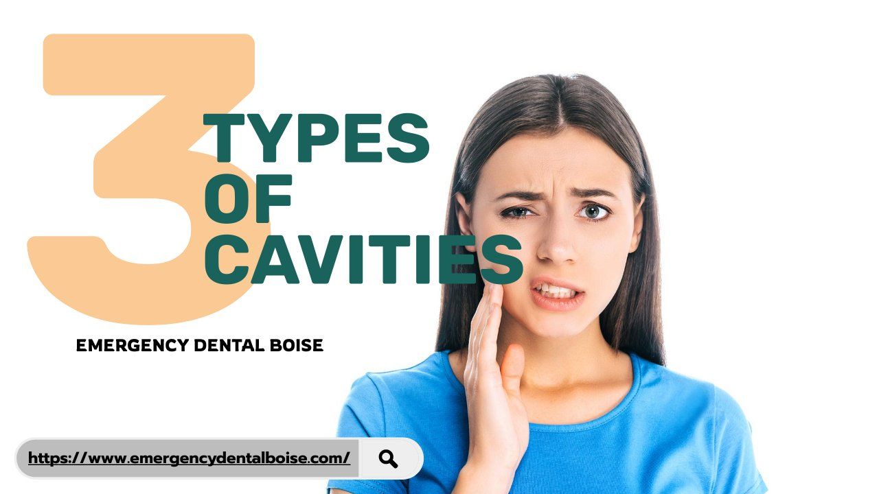 what-are-the-3-types-of-cavities-how-to-cure-tooth-decay