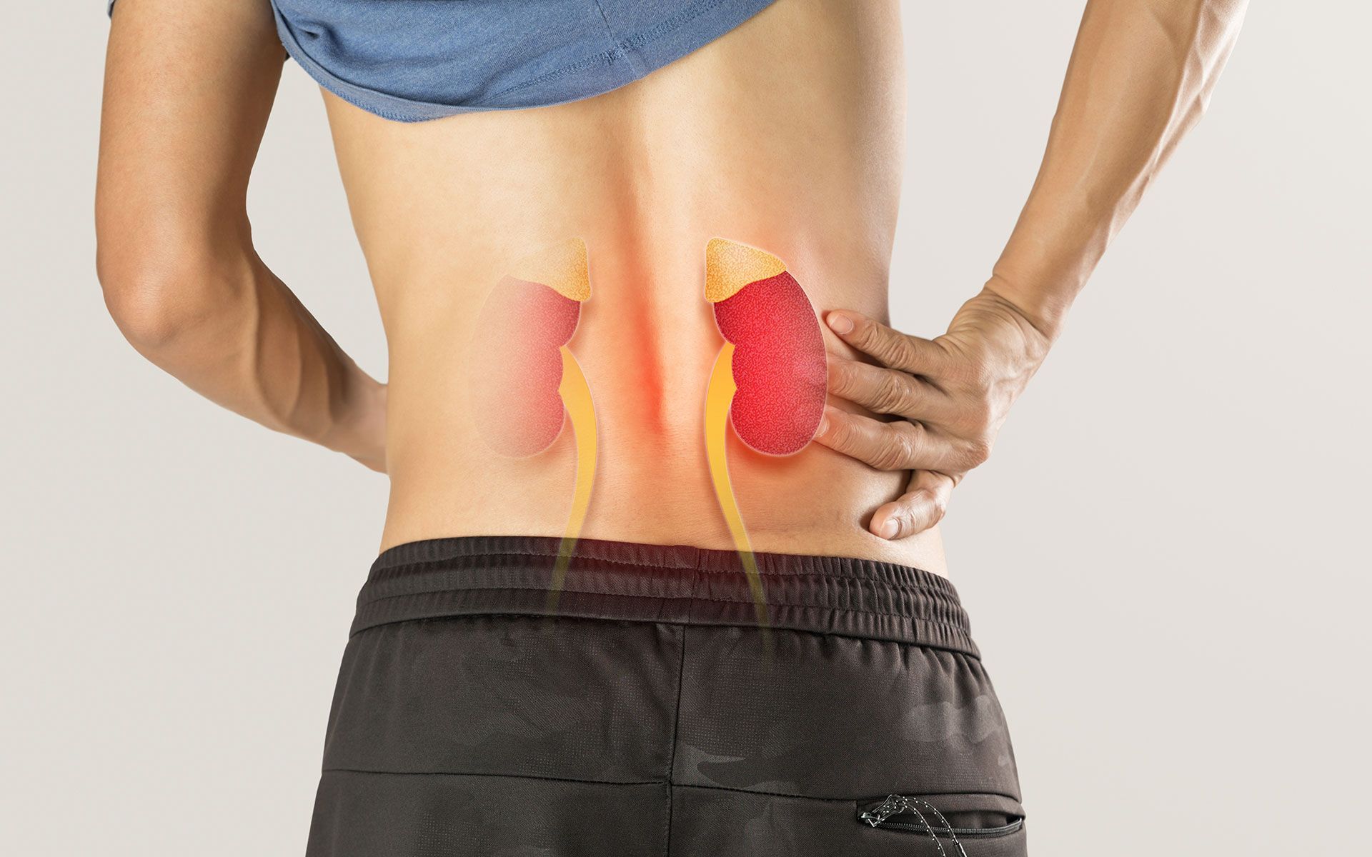 A man is holding his back in pain because he has kidney pain.