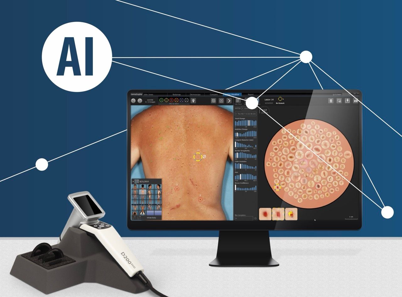 KI-gestütztes Hautanalysesystem: ein Gerät, ein Bildschirm mit Hautbildanzeige und KI-Grafikverbindungen.