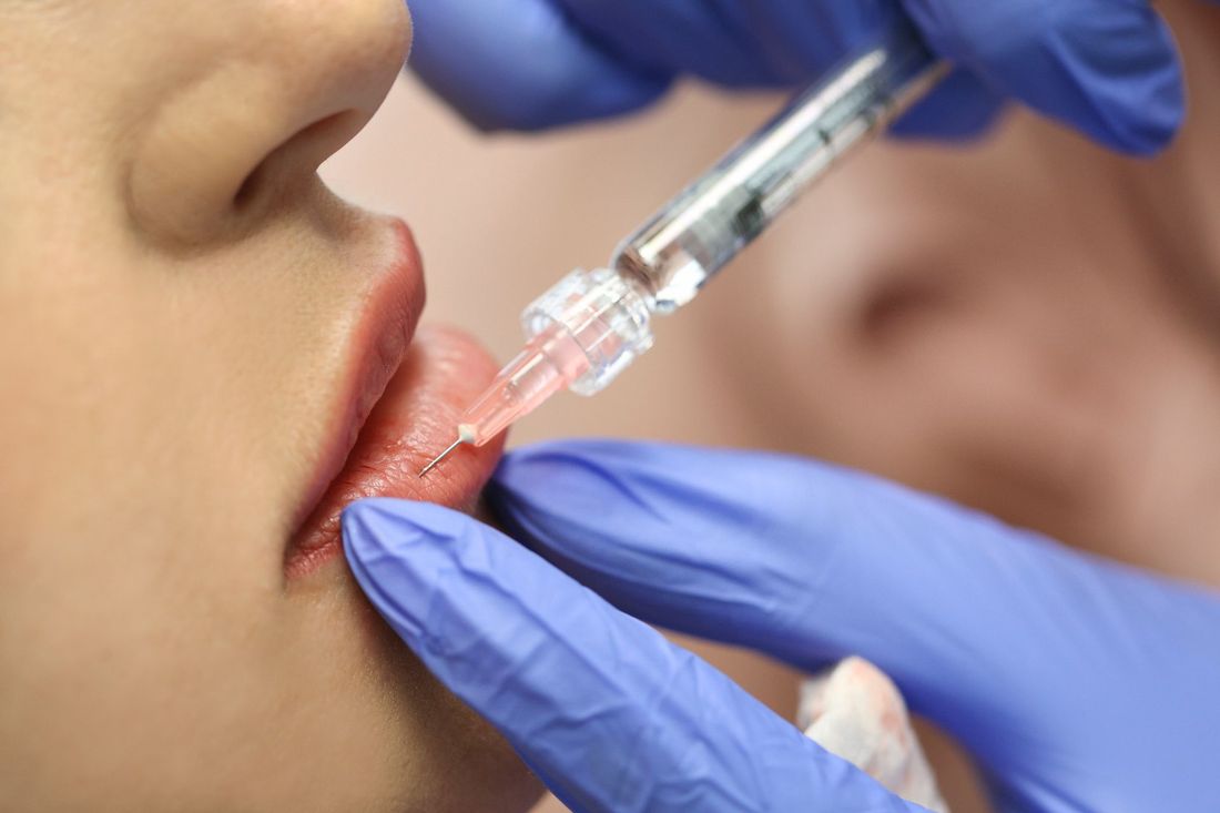 intervento dentale