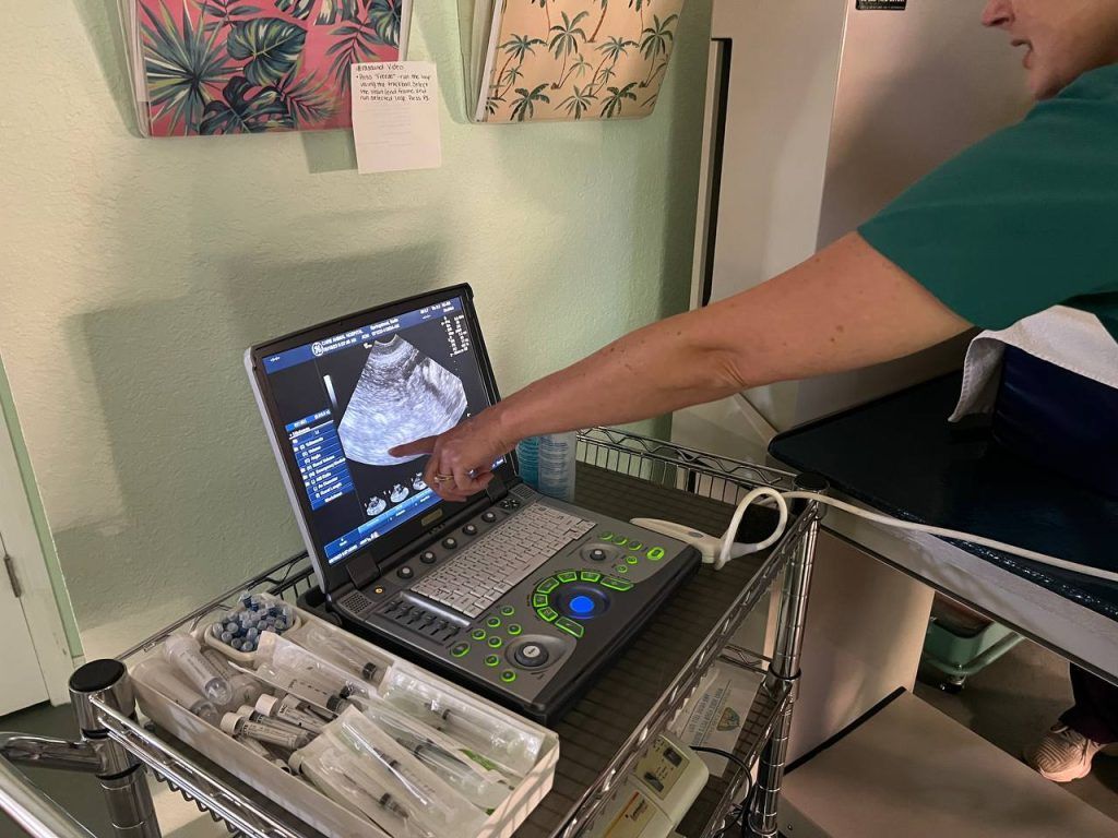 A person is pointing at a laptop computer on a table.