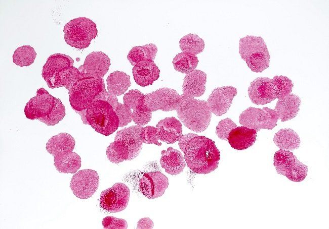 Sheila Naughton, Under the Microscope VII, acrylic on Yupo, Olivier Cornet Art Gallery