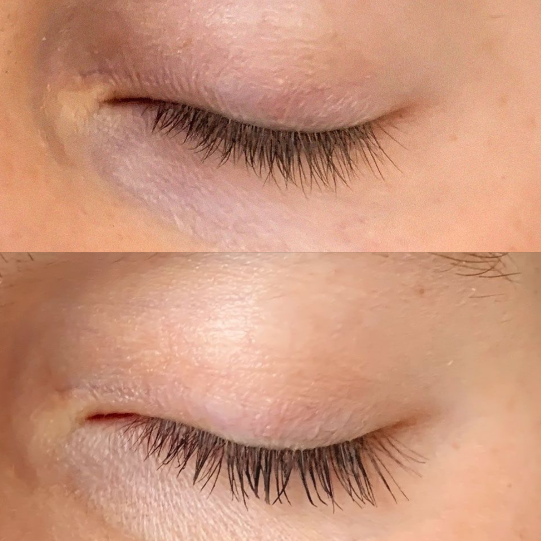 Lash tinting before and after