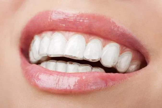 About Orthodontics