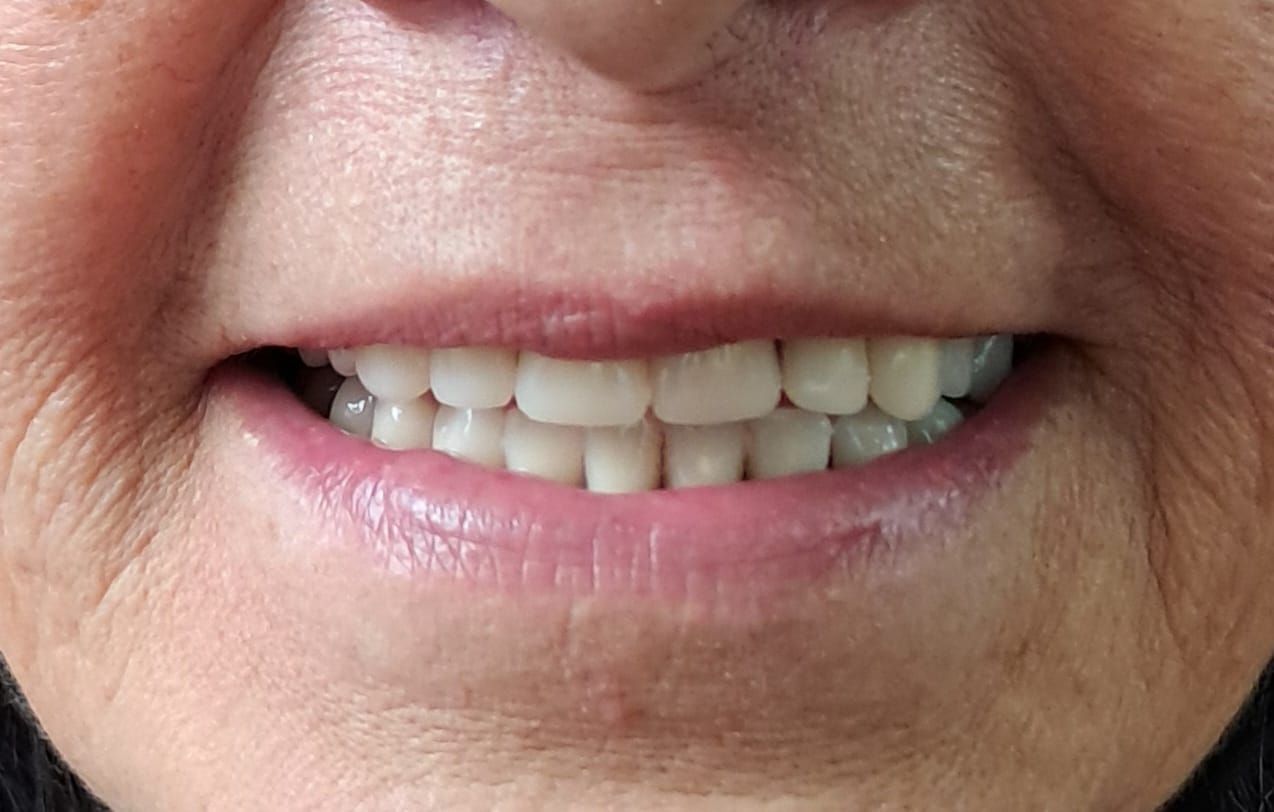 Primer plano de un hombre sonriente con barba y bigote canosos.