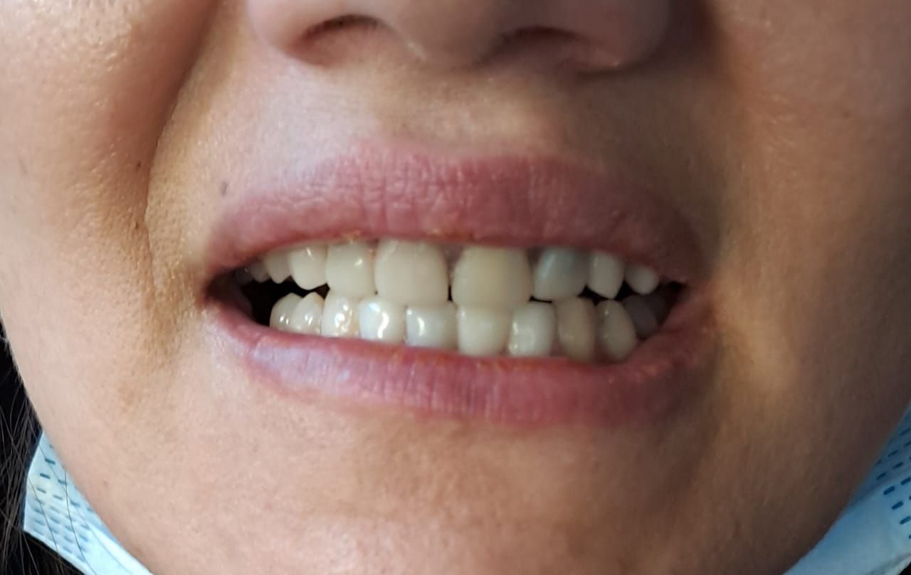 Primer plano de una persona con gafas, con la boca abierta de par en par