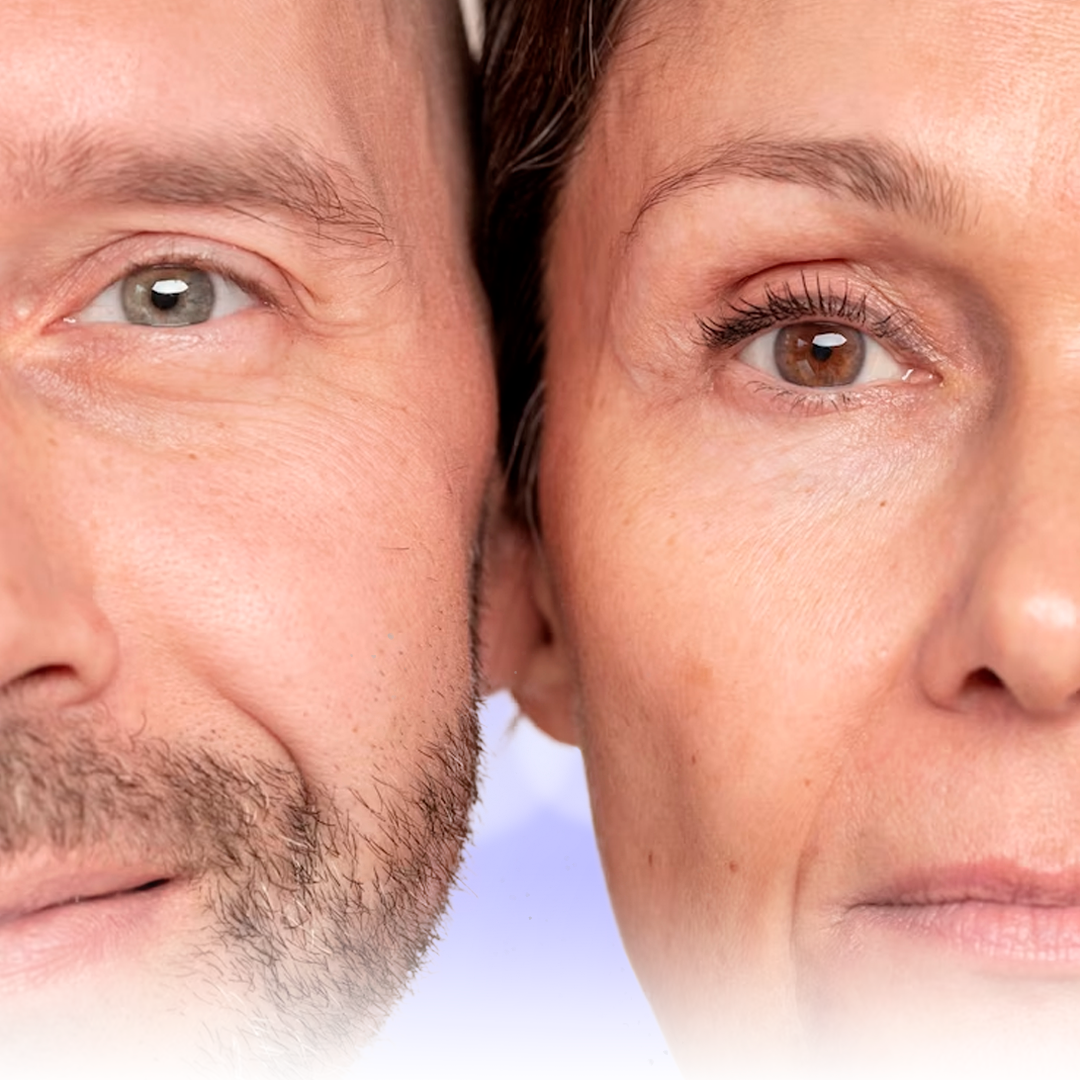 Rejuvenecimiento Facial