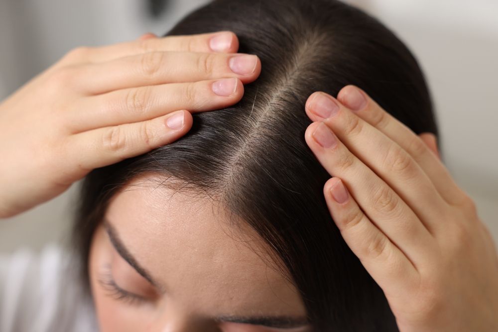Woman inspecting her scalp with both hands, dark hair parted.
