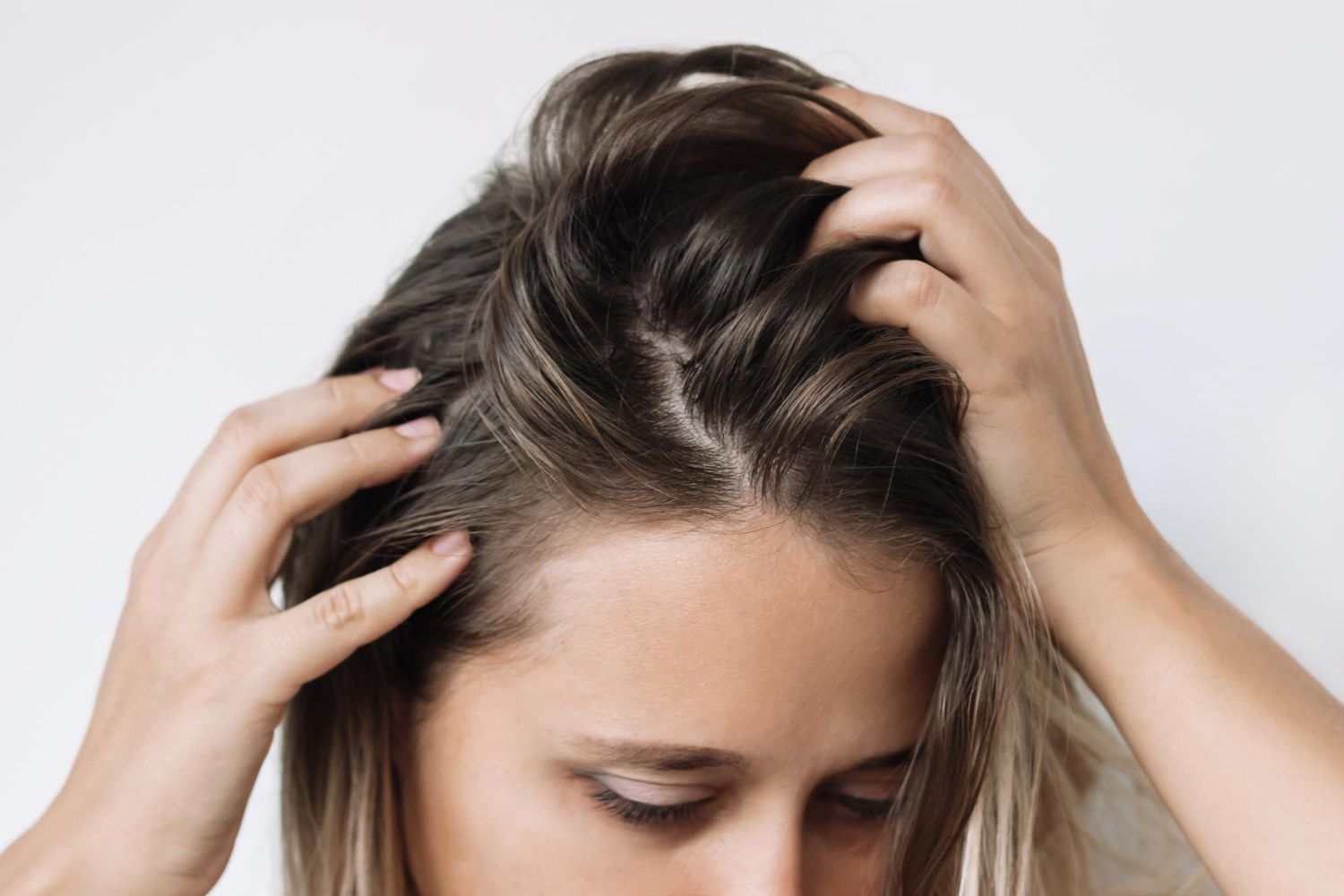 A woman is scratching her head with her hands.