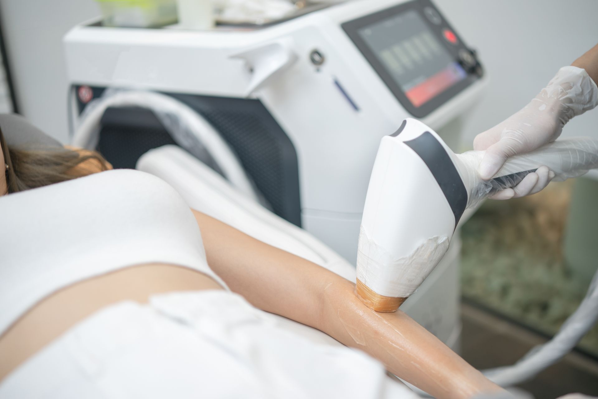 Woman receiving a laser treatment on her arm in a clinic, with a handheld device near the skin.