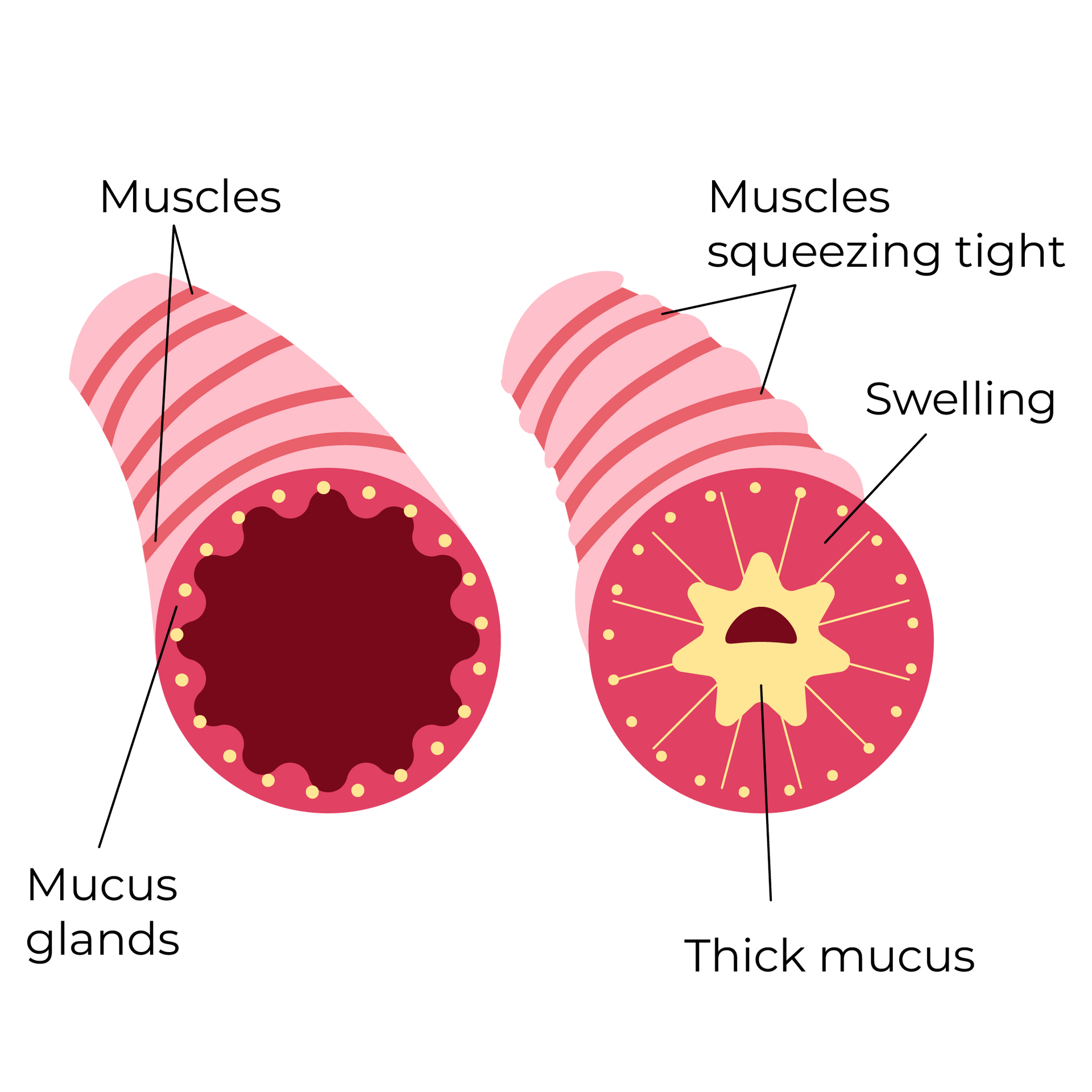 A diagram of a muscle and a thick mucus gland.