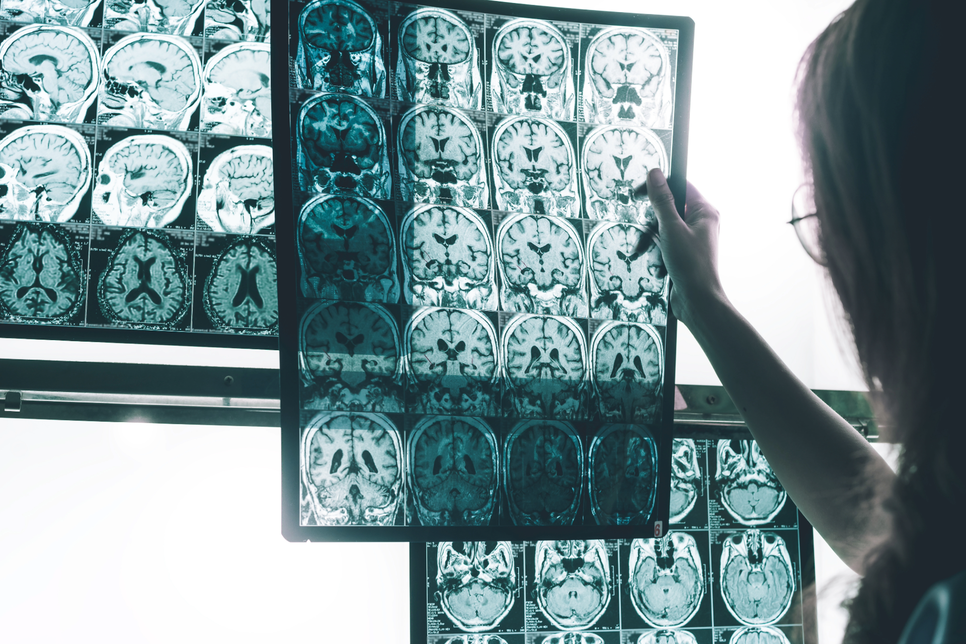 Person examining brain scan images.