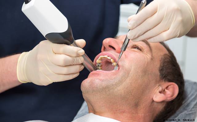 Digitale Aufnahme der Zähne mit der Cerec-Kamera