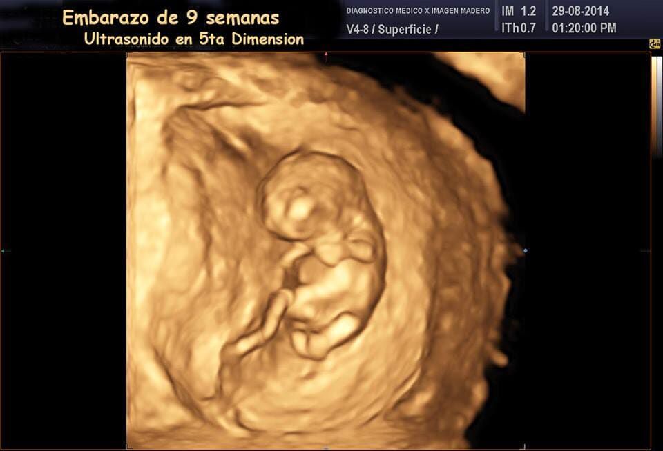 Diagnóstico Médico X Imagen Madero S.C.