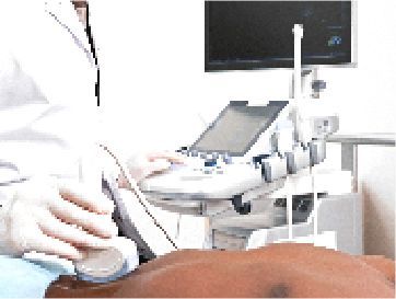 醫生正在對病人的胃部使用超音波機器。