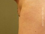 Close-up of a person's upper arm, showing the side of the arm and part of the armpit. Skin is light brown.