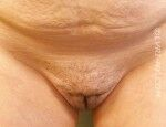Close-up of human genitalia, with visible folds and a small amount of pubic hair.