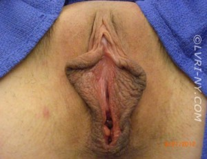 Close-up view of a vulva with pronounced labia. The area is pink and brown with a visible opening.