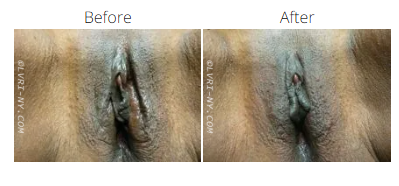 Comparison of the appearance of a vulva