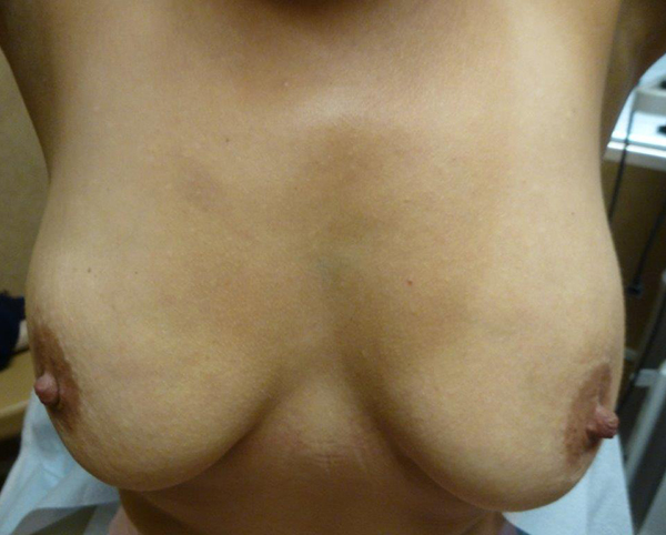 Torso with two breasts, brown nipples. Skin tone appears fair.