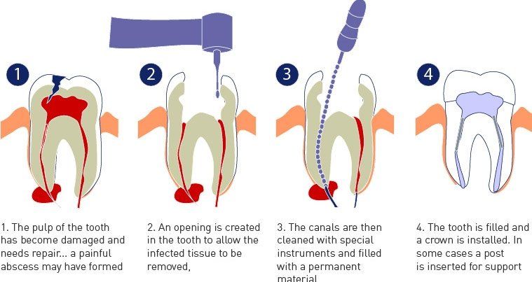 Special Teeth Treatments - Fontana, CA - Fontana Dental Group