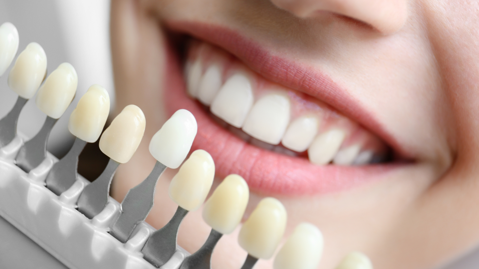 a close up of a woman 's teeth with a tooth color chart in front of her .