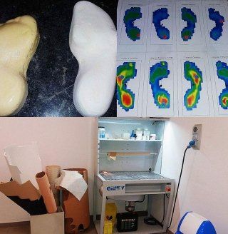 creazione plantari su misura