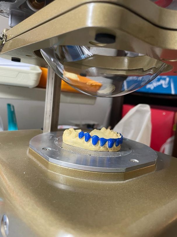 IMPLANTOLOGIA GUIDATA