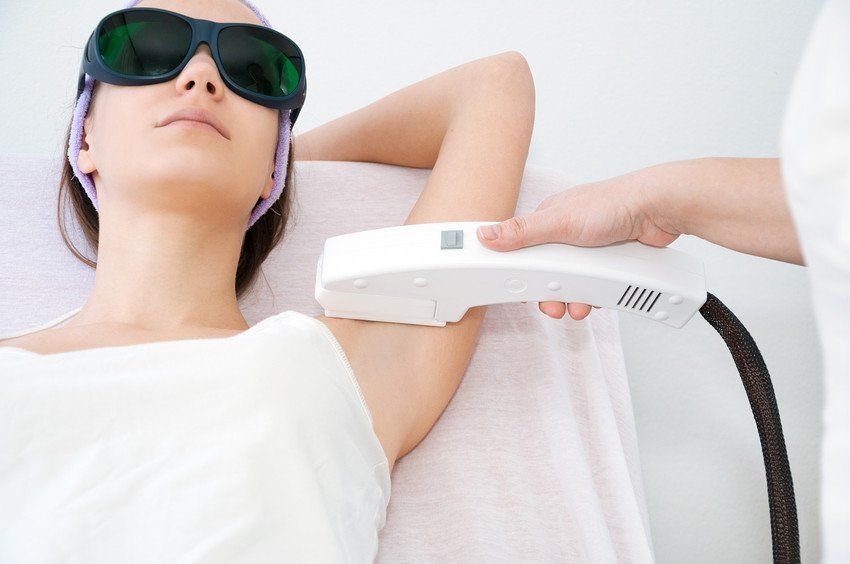 Laser epilation treatment