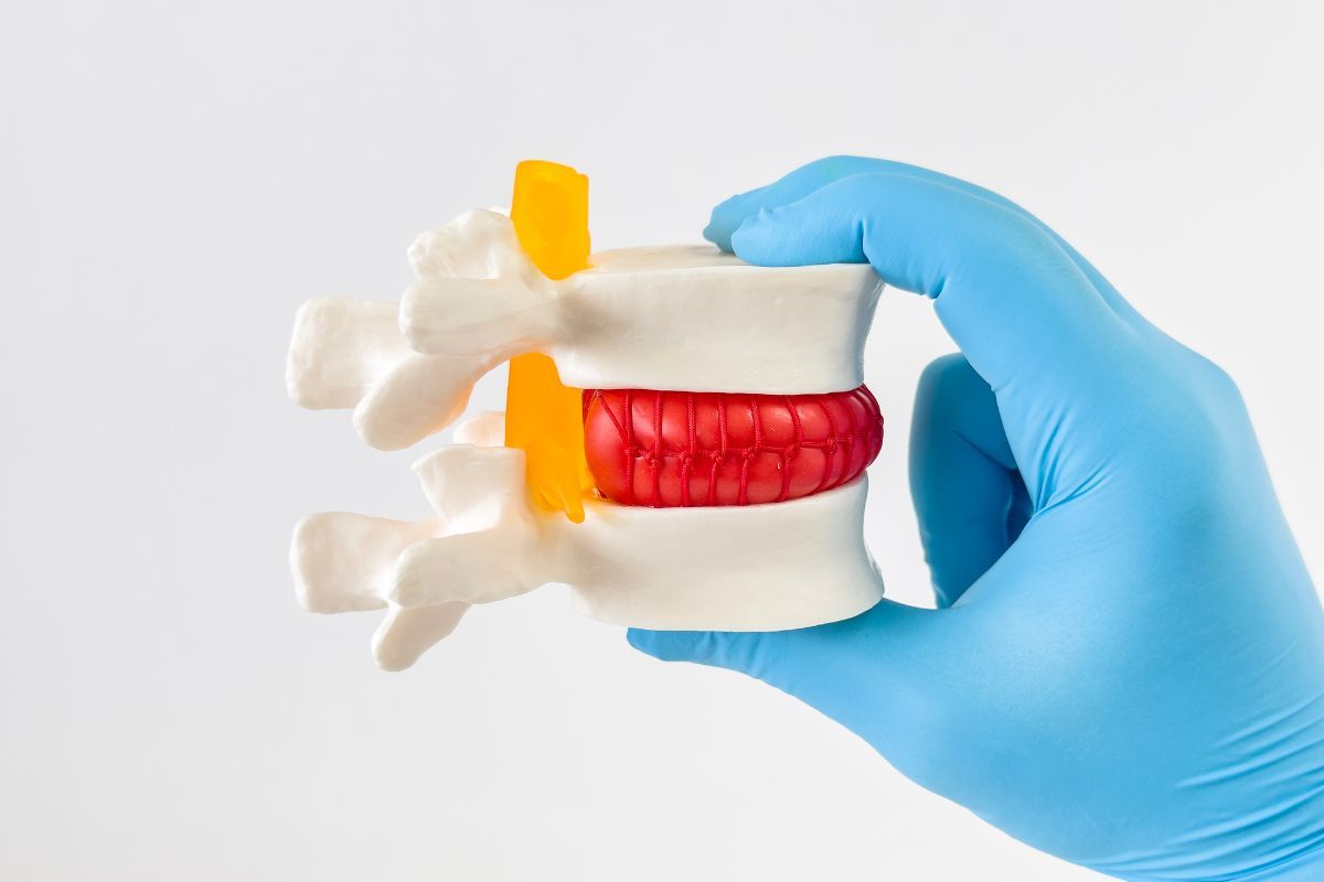 dor-ciatica-sintomas-clinica-wavetech-sao-paulo