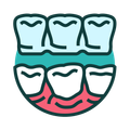 Diagram of a set of teeth, showing the upper and lower teeth with gums. The upper teeth are light blue, while the lower teeth and gums are reddish-pink.