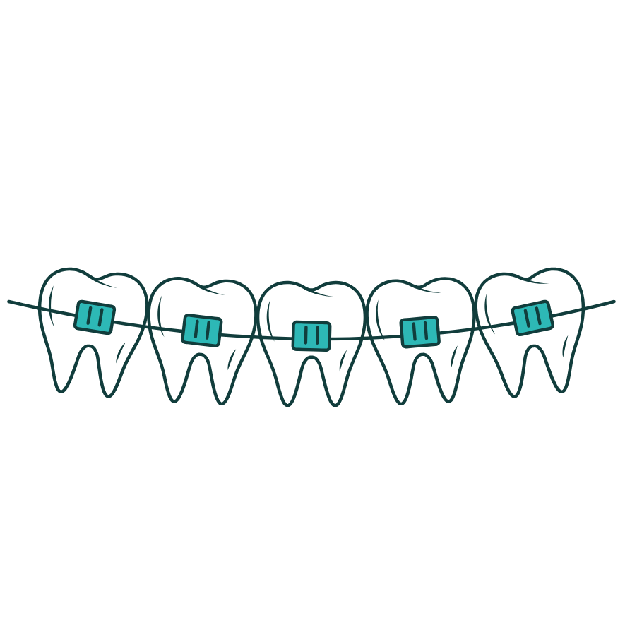 Teeth with teal braces and wires, representing orthodontic treatment.