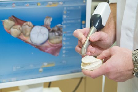 Dentist using a 3D scanner on a dental model, with a digital tooth model displayed on a computer monitor.