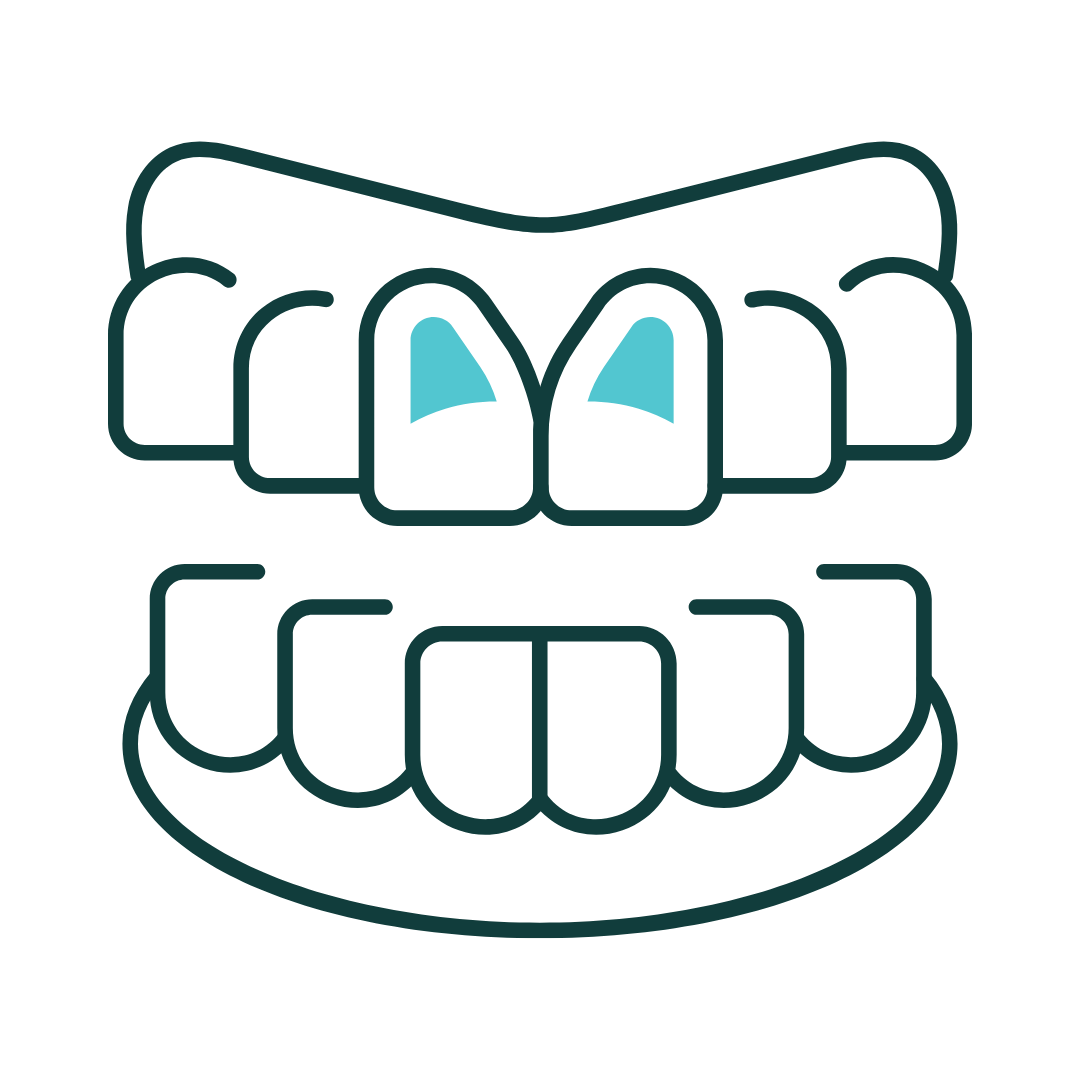 Diagram of a set of teeth, showing the upper and lower teeth with gums. The upper teeth are light blue, while the lower teeth and gums are reddish-pink.