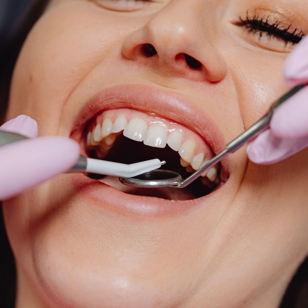 Woman at the dentist's office with mouth open, being examined with dental tools by a person wearing pink gloves.